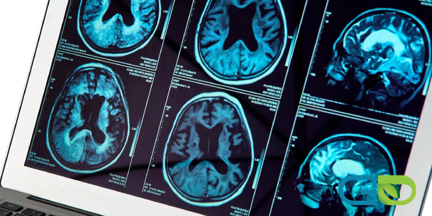 خواب برای پاکسازی مغز از سموم